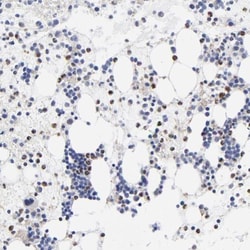 Brachyury Antibody, Novus Biologicals 25 &mu;L; Unlabeled:Antibodies, Polyclonal